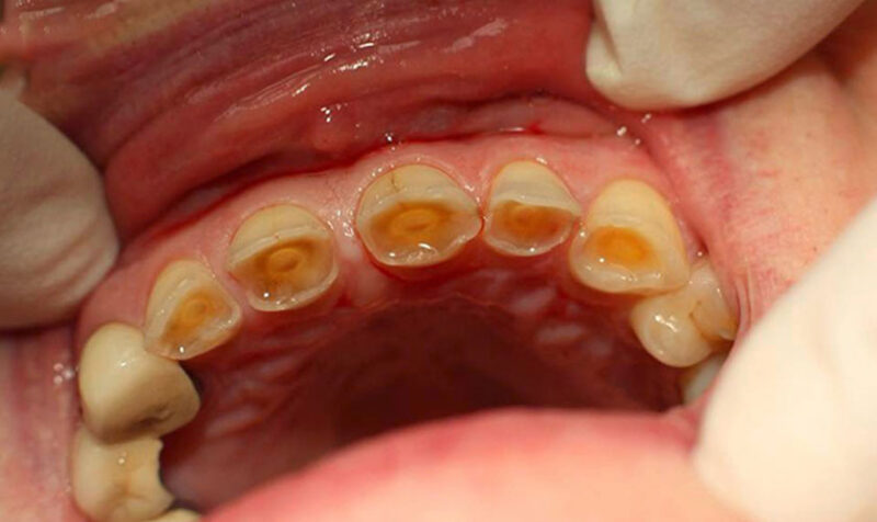 sai-khop-can-5-hau-qua-nguy-hiem-cho-suc-khoe