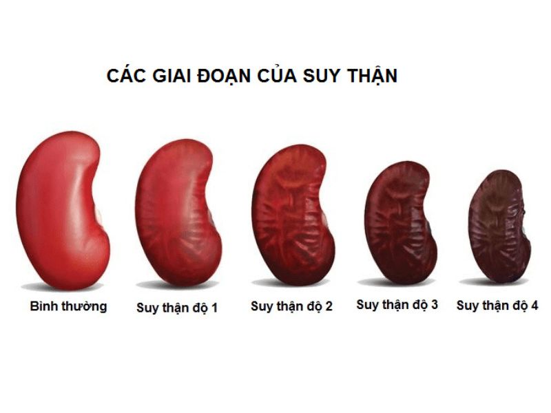 4-dau-hieu-suy-than-giai-doan-som-canh-bao-truoc