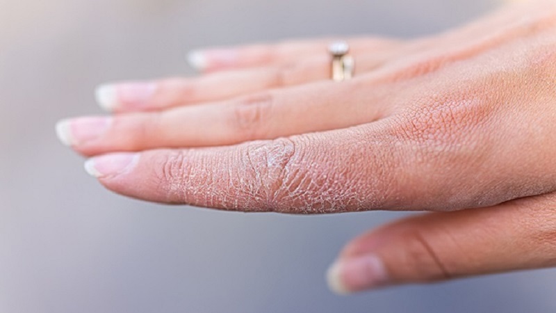 4-dau-hieu-suy-than-giai-doan-som-canh-bao-truoc