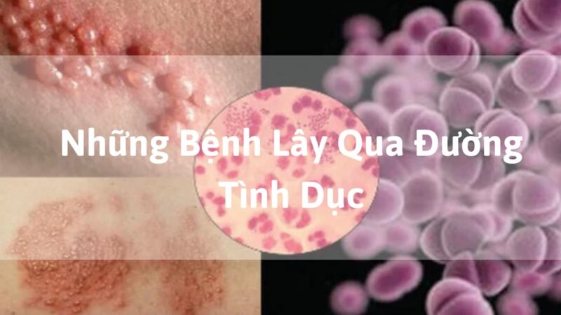 quan-he-lan-dau-nhung-van-co-nguy-co-mac-sti