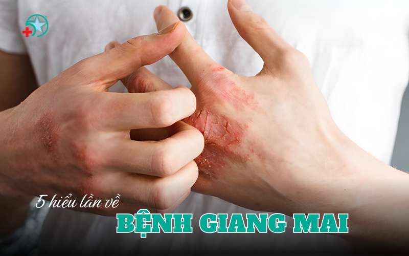 5-hieu-lam-ve-benh-giang-mai-khien-nhieu-nguoi...