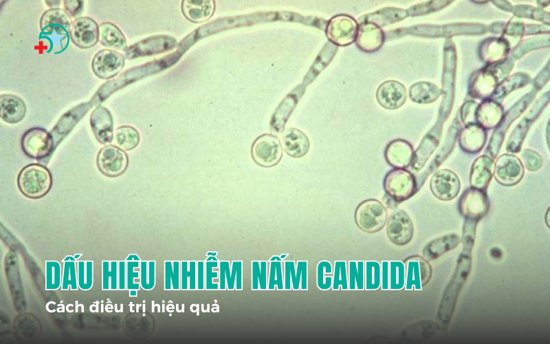 dau-hieu-nhiem-nam-candida-la-gi-cach-phong-benh