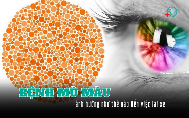 benh-mu-mau-la-gi-mu-mau-anh-huong-gi-den-lai-xe