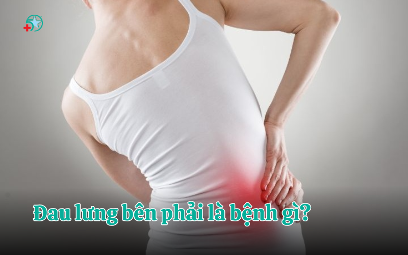 dau-lung-ben-phai-la-benh-gi-phan-biet-dau-co-voi