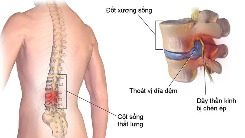 thoat-vi-dia-dem-co-chua-khoi-duoc-khong-khi-nao