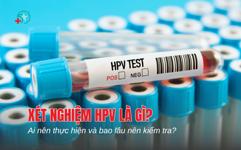 xet-nghiem-hpv-la-gi-ai-nen-thuc-hien-va-bao-lau