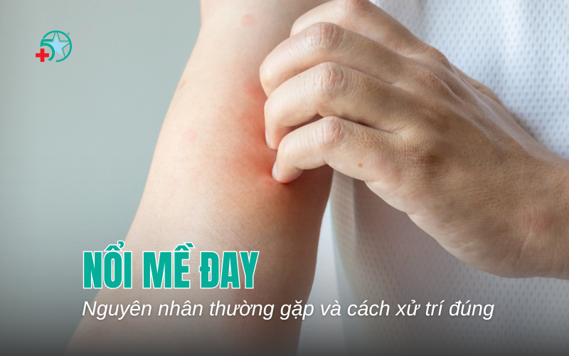 noi-me-day-khap-nguoi-nguyen-nhan-thuong-gap...
