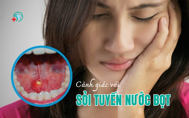 sung-duoi-luoi-canh-giac-voi-soi-tuyen-nuoc-bot..