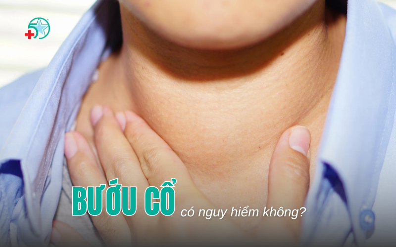 buou-co-co-nguy-hiem-khong-khi-nao-can-sieu-am...