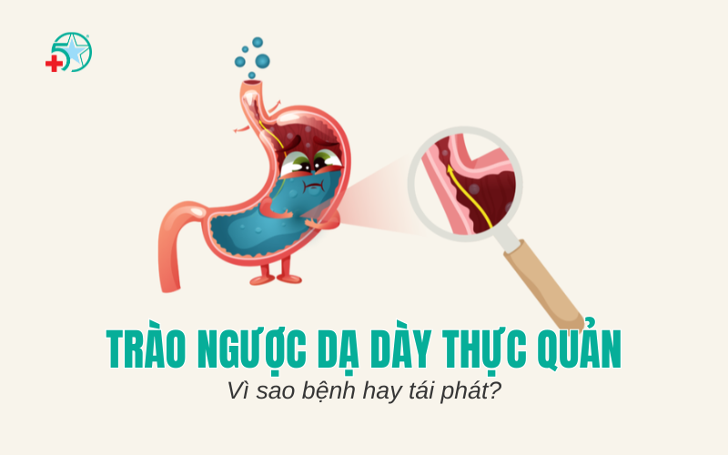 trao-nguoc-da-day-thuc-quan-vi-sao-benh-hay-tai..