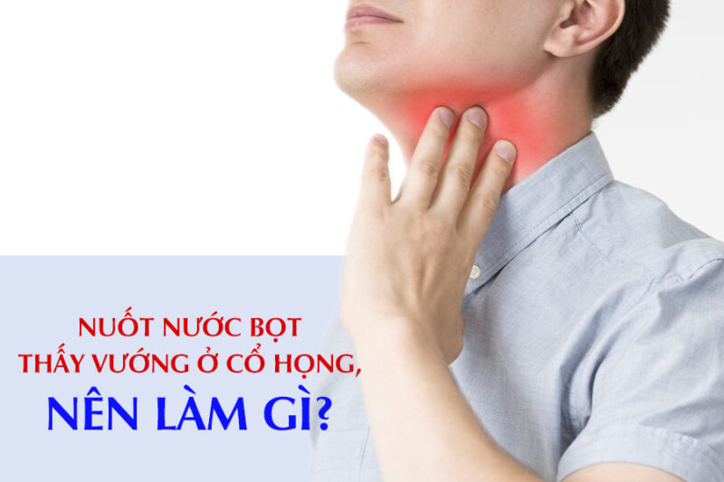 nuot-nuoc-bot-thay-vuong-o-co-nhung-khong-dau